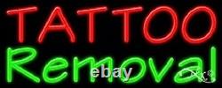 BRAND NEW TATTOO REMOVAL 32x13 REAL NEON SIGN withCUSTOM OPTIONS 11485